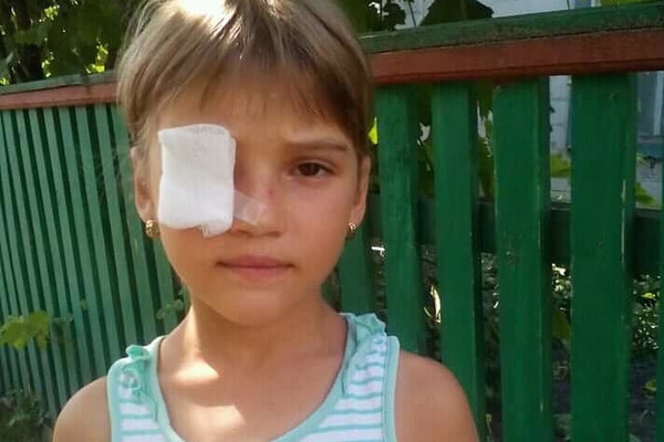 Дитині, яка може втратити око, терміново потрібна операція