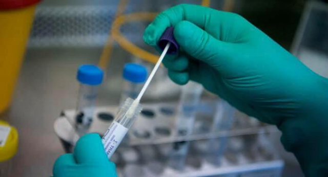 На Черкащині підтвердили 15 випадків інфікувань COVID-19 за добу