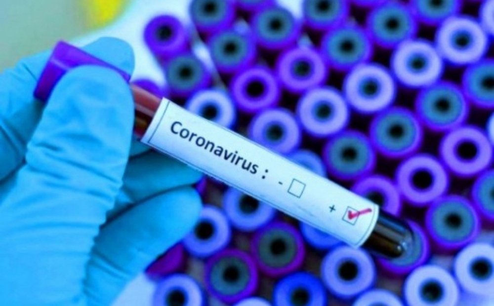 +5 за добу: оперативна інформація про поширення коронавірусу