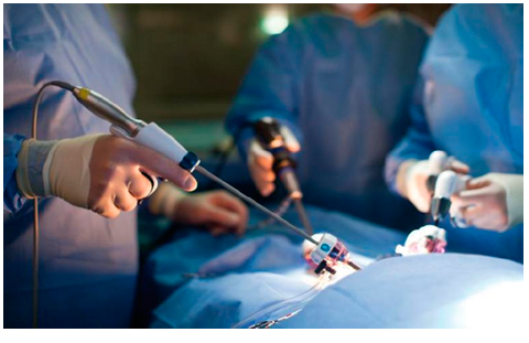 В онкодиспансері проводитимуть операції з використанням ультразвукового скальпелю (ВІДЕО)
