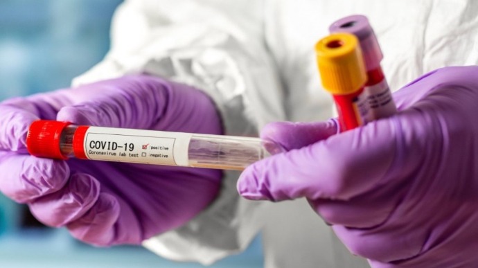 Майже 700 інфікованих коронавірусом черкащан виявили за добу
