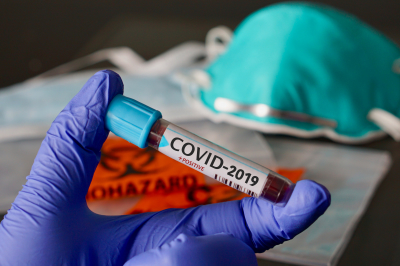 На Черкащині зафіксували 146 випадків коронавірусної інфекції