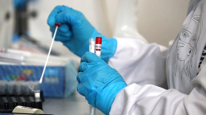 На Черкащині зафіксували понад 300 випадків інфікування коронавірусом