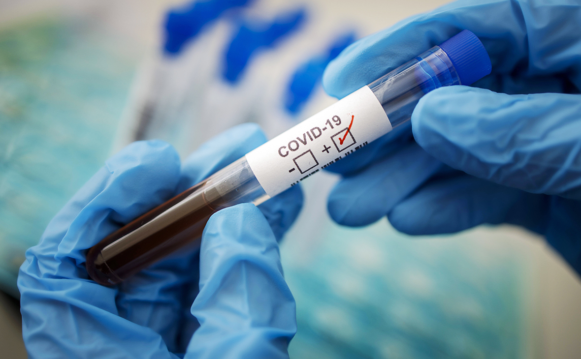 5 372 випадків за добу: статистика поширення коронавірусу в Україні