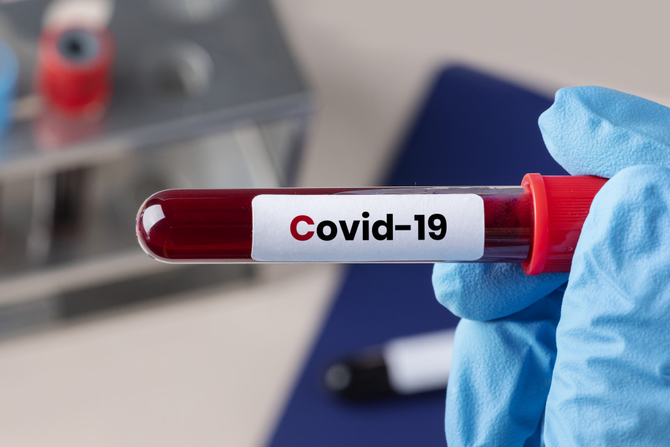 Статистика COVID-19: на Черкащині 224 нових випадків