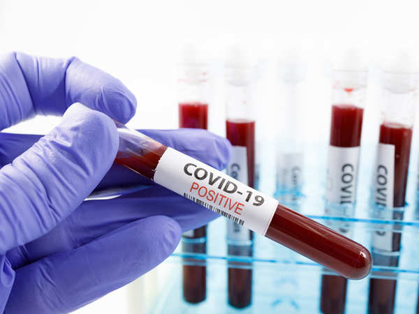 На Черкащині виявили майже 700 випадків захворювання коронавірусом
