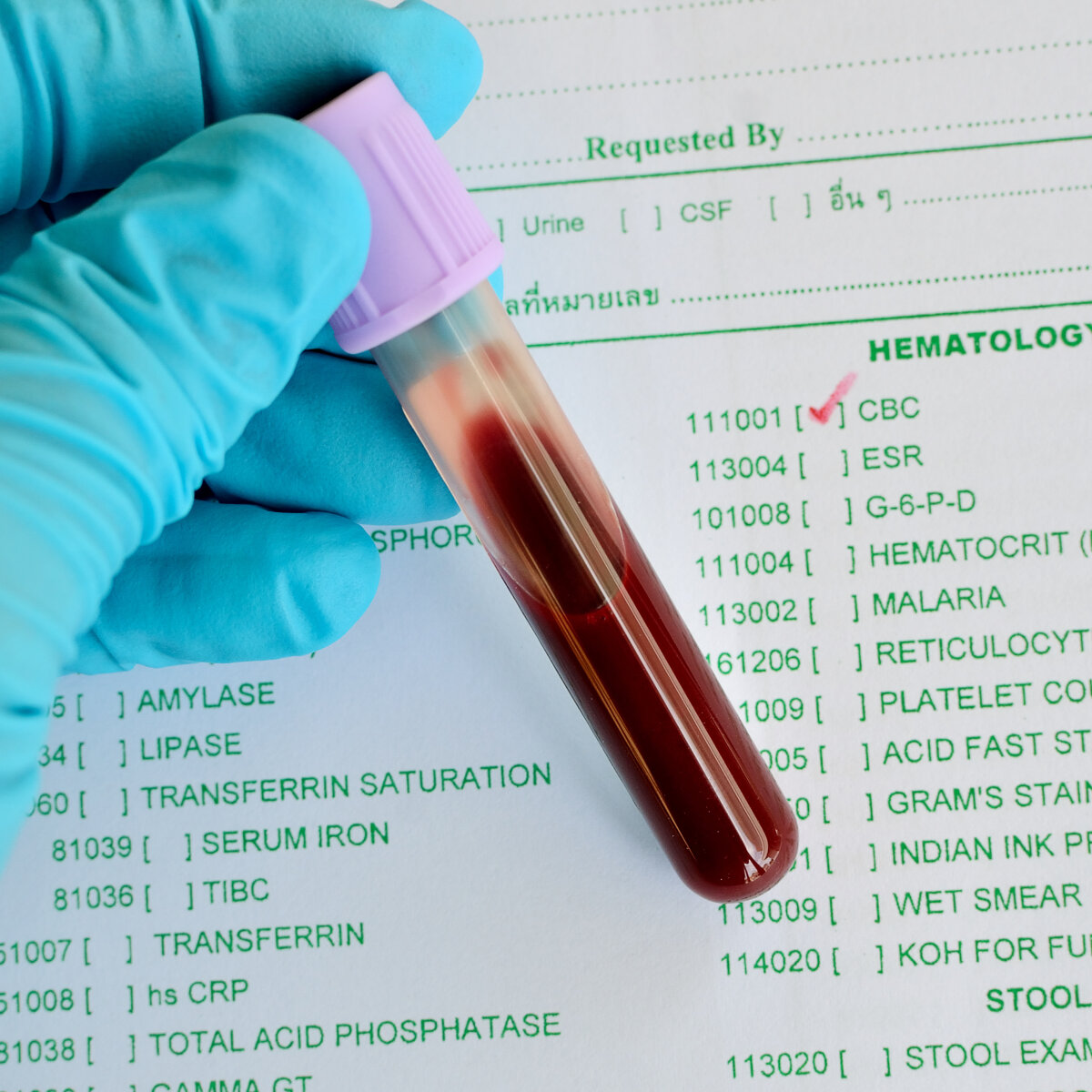 Чи потрібно заздалегідь здавати аналізи та проходити медогляд перед донацією крові?
