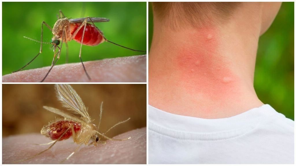 Які захворювання передаються через укуси комарів і як від них захиститися